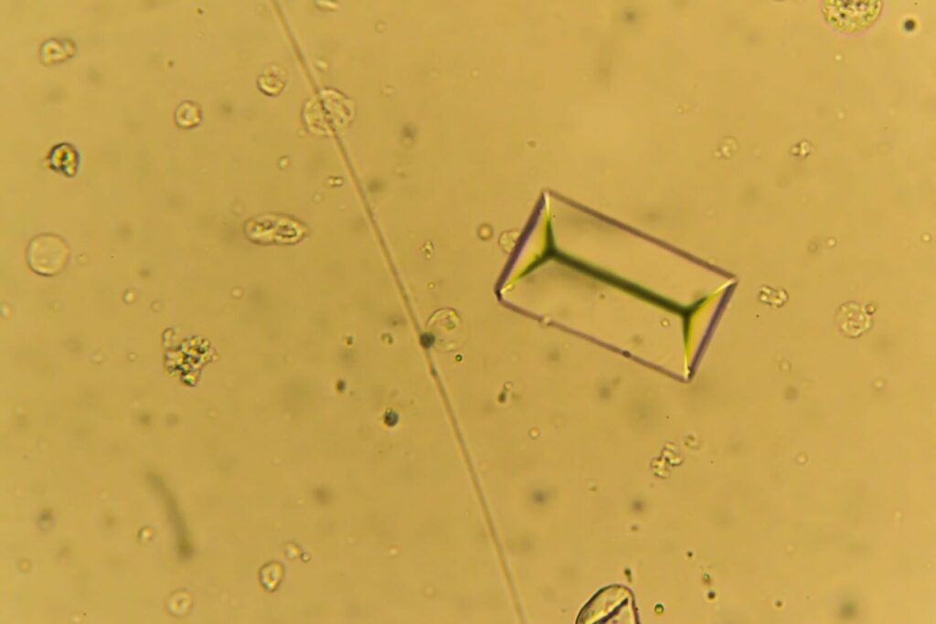 Calculs vésicaux de chien au microscope