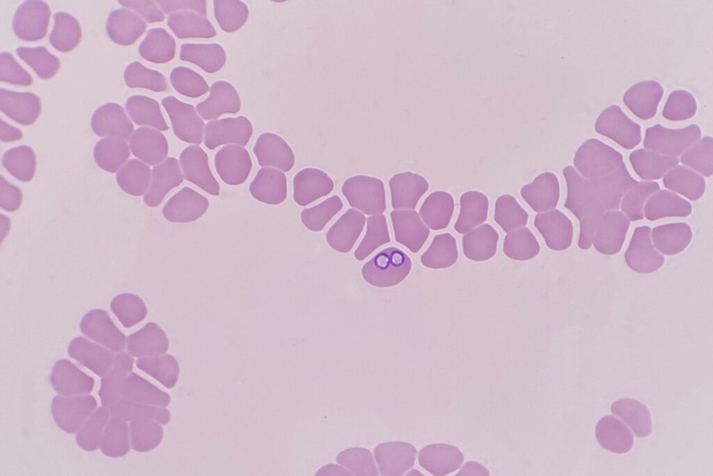 parasites de babésie à l'origine de la piroplasmose du chien