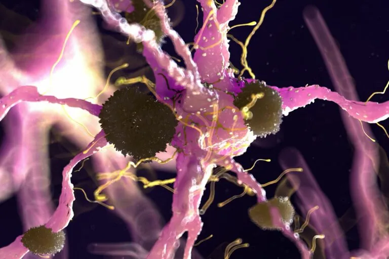 Les protéinse amyloïdes s'accumulent en cas d'Alzheimer